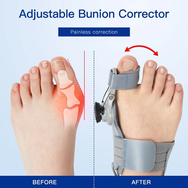 Aussie Point Hub™️ Ergonomic Bunion Fix